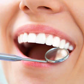 Closeup of healthy smile