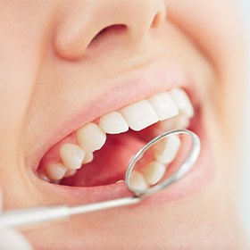 Closeup of healthy smile