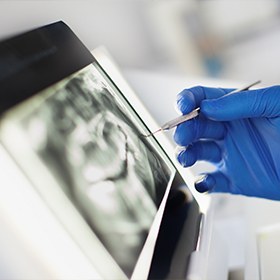 Digital dental x-rays on tablet computer