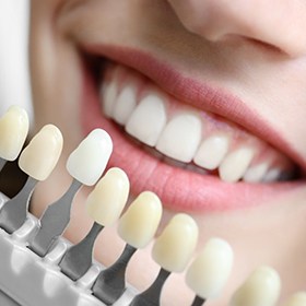 a cosmetic dentist matching the shade of a patient’s teeth to a chart