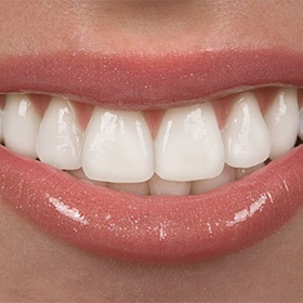 A closeup of a white smile.